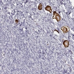 ZP3 Antibody, Novus Biologicals:Antibodies:Primary Antibodies